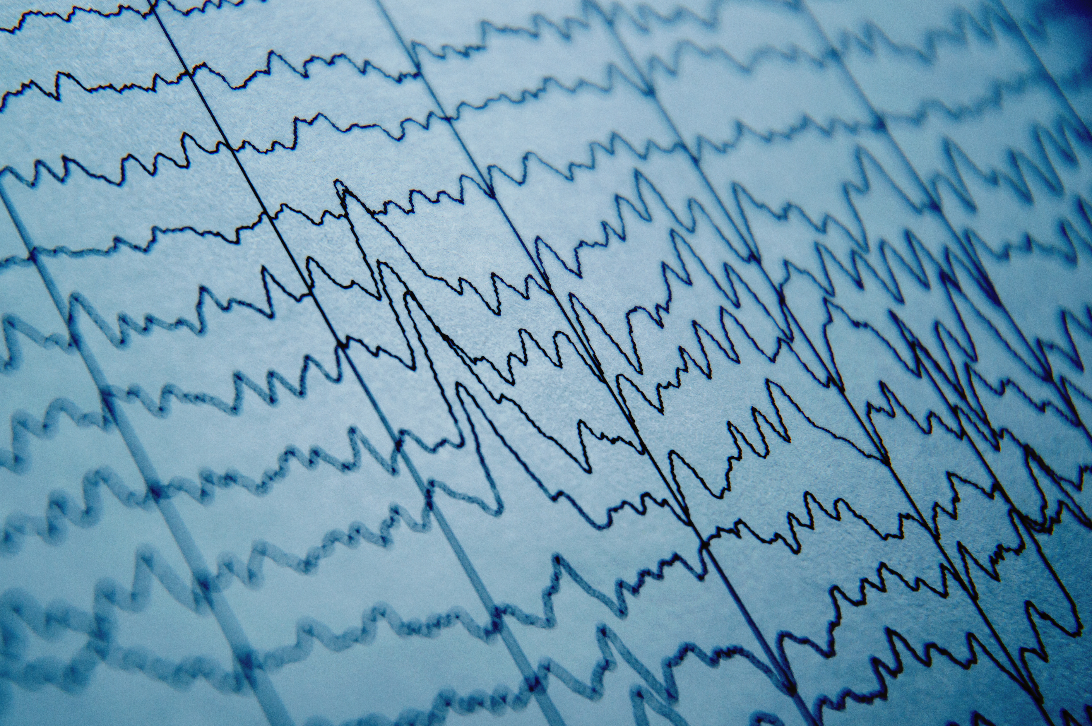 EEG reading